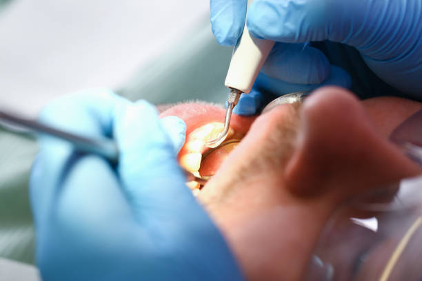 Best Emergency Dental Care for Broken or Chipped Teeth in Middlebranch, OH